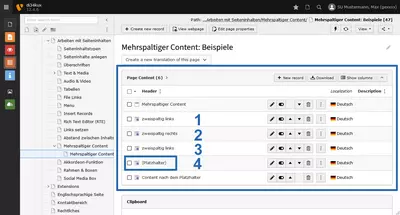 Screenshot: Platzhalter im Backend
